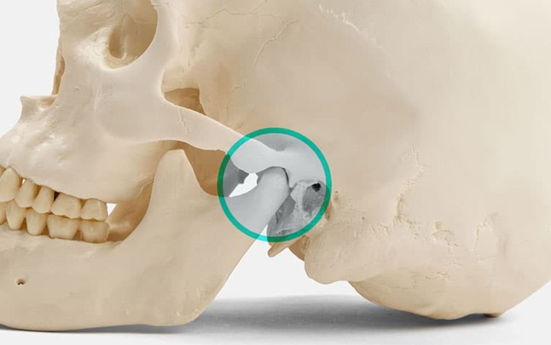jawbone model