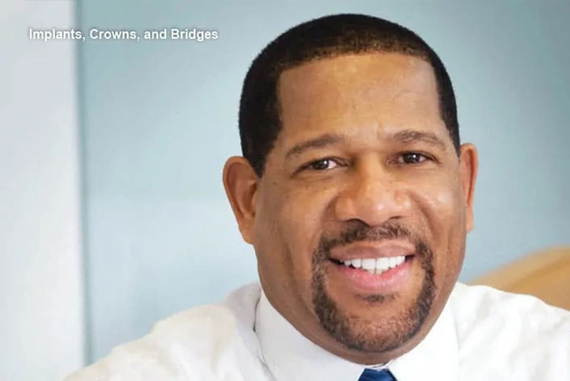 Dental Implants Hagerstown, MD Smile Design Centre