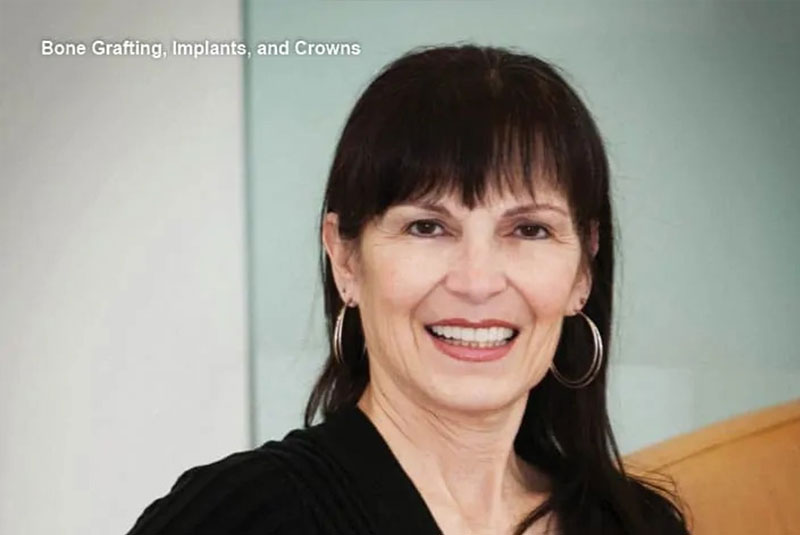 lori - bone grafting patient